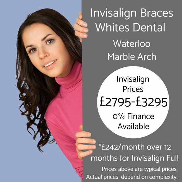 Invisalign braces cost in London at Whites Dental clinics in Waterloo and Marble Arch