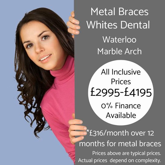 Metal braces cost at Whites Dental In London