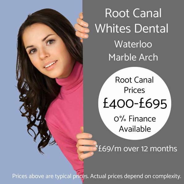 Root Canal Cost - Whites Dental London