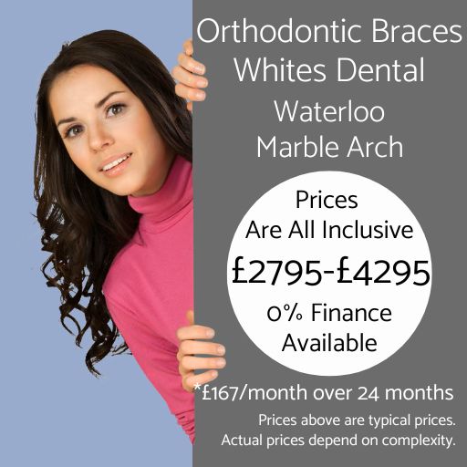 Orthodontist treatment in London at Whites Dental