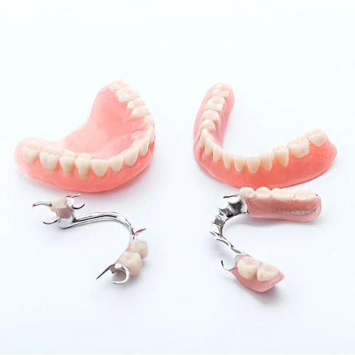 Metal Full Dentures