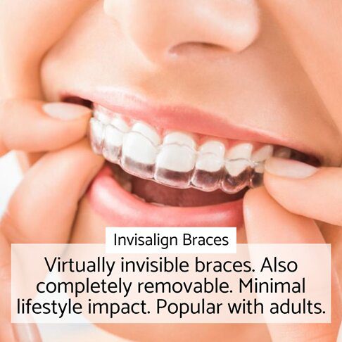 Orthodontic braces - Invisalign