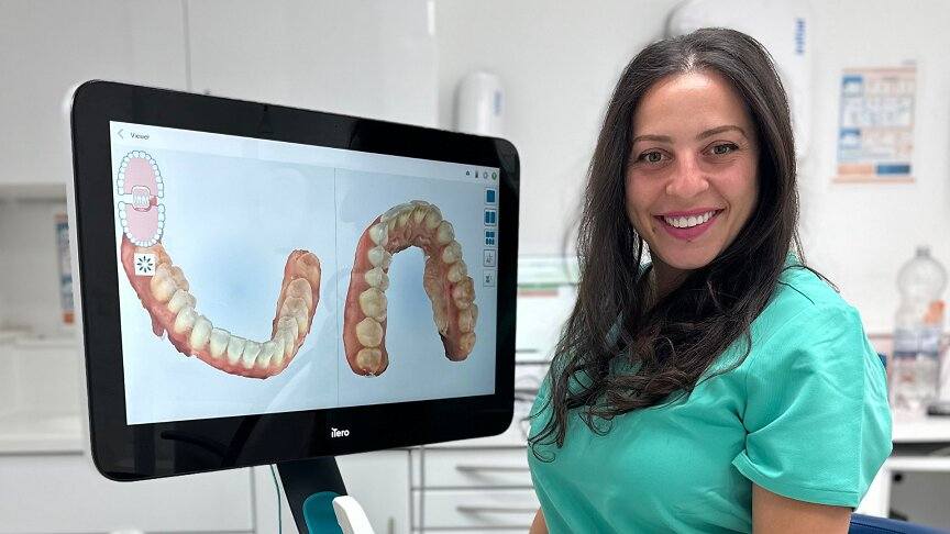 Benefits of acrylic dentures in London