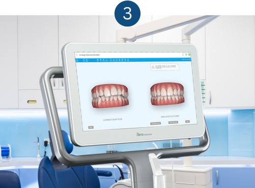 Step 3 after care after emergency dental treatment