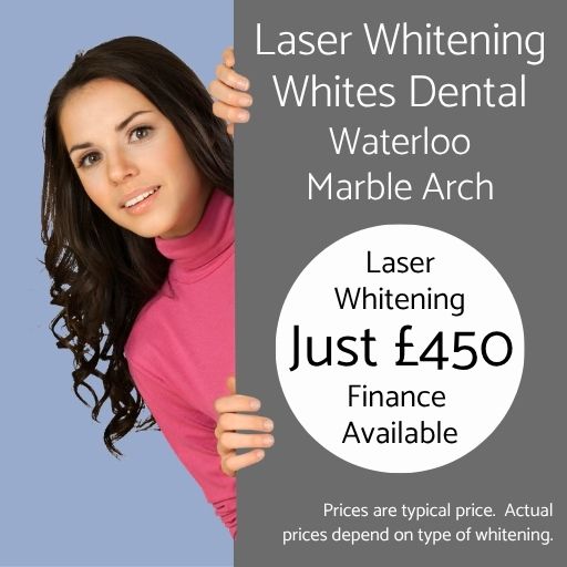 Laser teeth whitening cost at Whites Dental in London